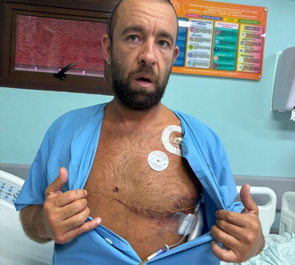 Surfista brasileiro é atingido no peito por peixe-agulha durante sessão na Costa Rica